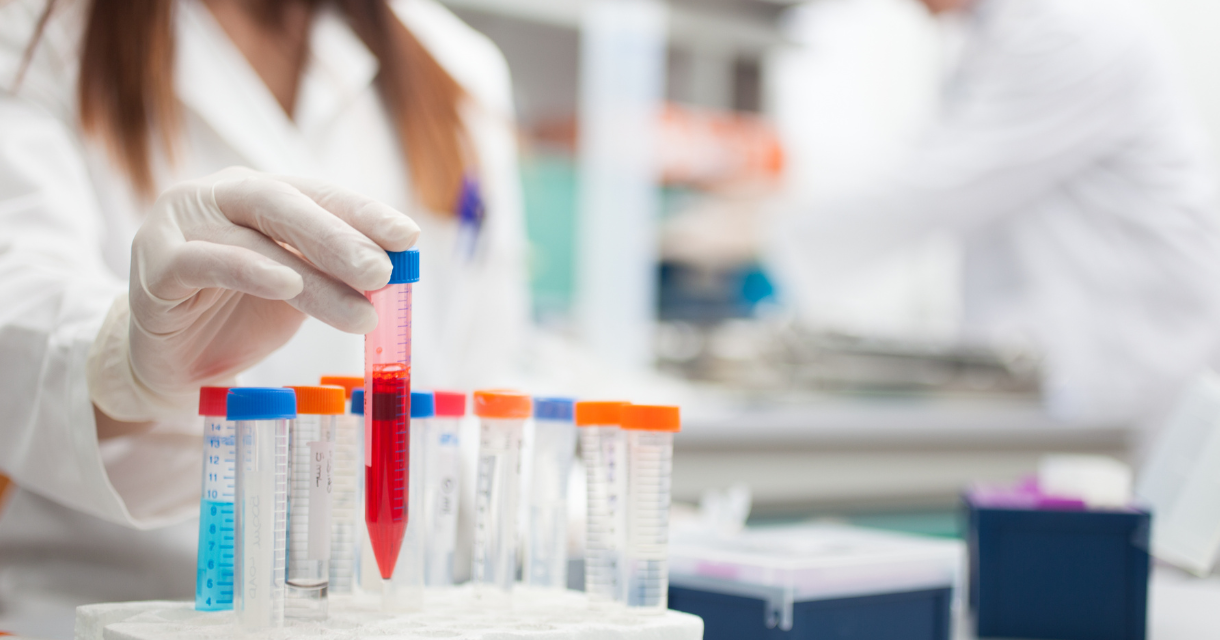 Pharmazie: Vertriebsprognosen und Bestandsmanagement